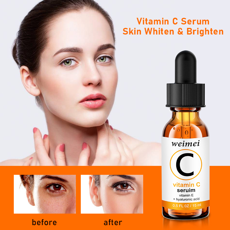 Serum vitamin C